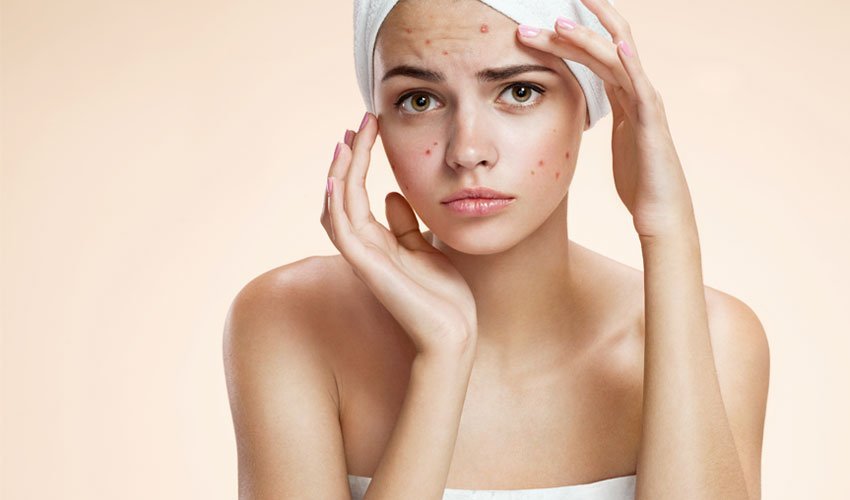 How Hormones Affects the Skin?