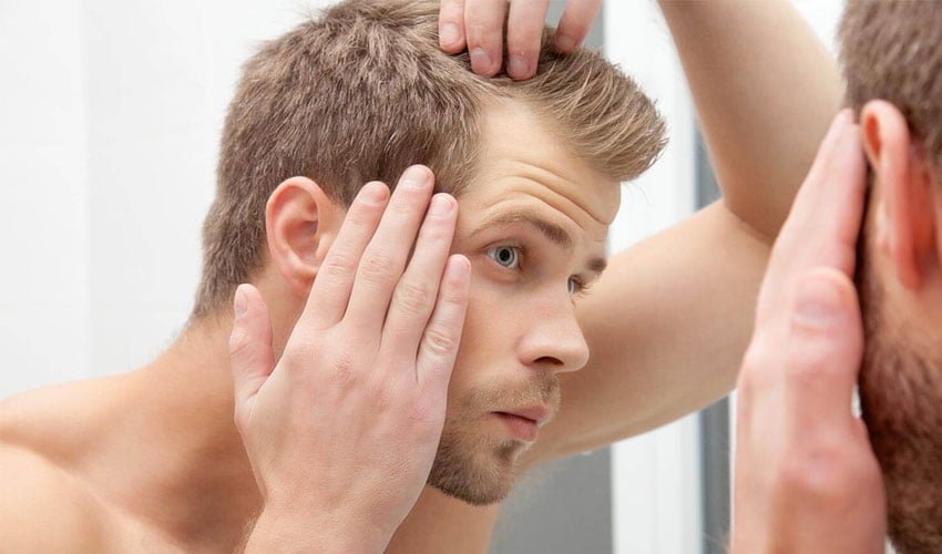 Facing Hair Loss Problems? Try Hair Transplant