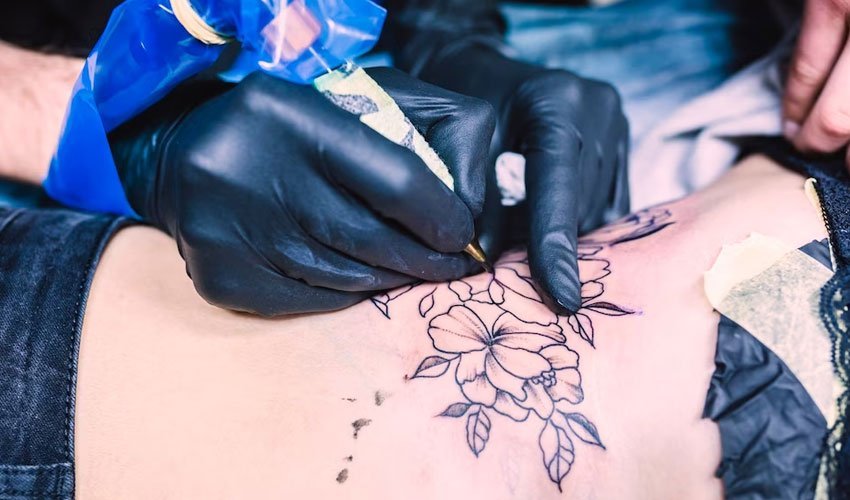 What to Expect During the Laser Tattoo Removal Procedure?